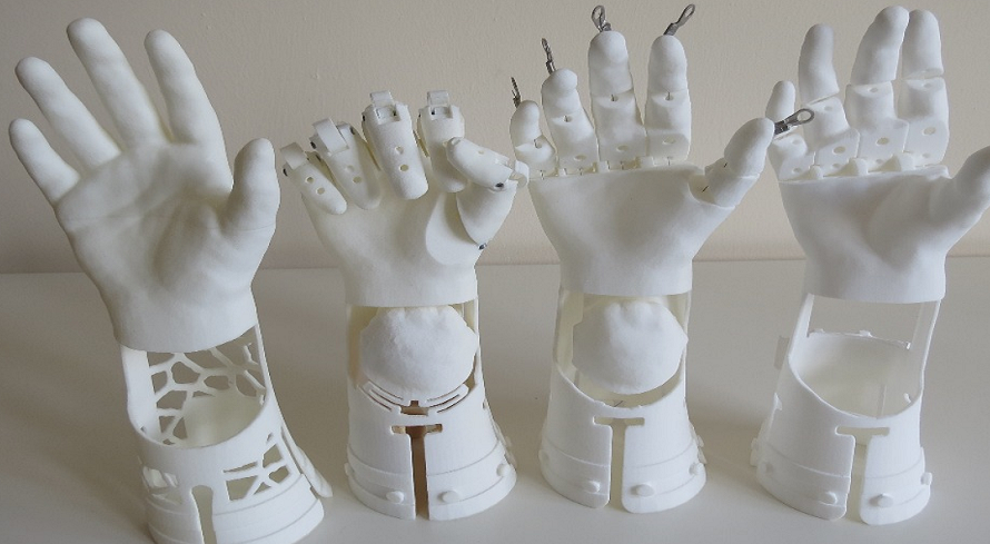 SLS Nylon 3D Printed Prosthetic Hand Seeks Funding on GoFundMe