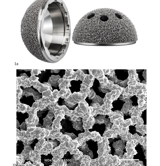 Peking University Third Hospital: Follow-Up of 92 Consecutive Patients with 3D Printed Titanium Acetabular Cups