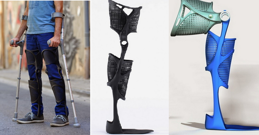 KAFO Splint — 3D Printed Leg Brace Customized for a Perfect Fit