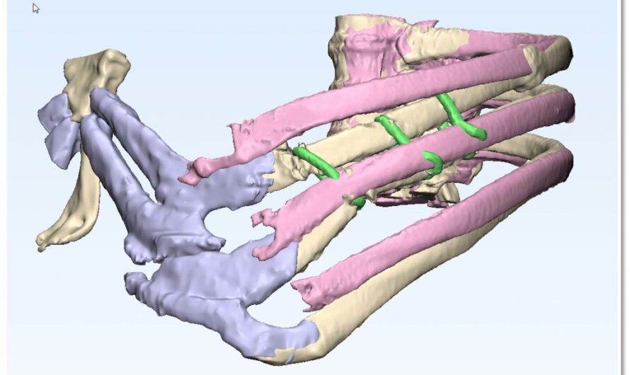 Mayo Clinic Researchers 3D Printing Models & Surgical Guides for Chest Wall Reconstructive Surgery