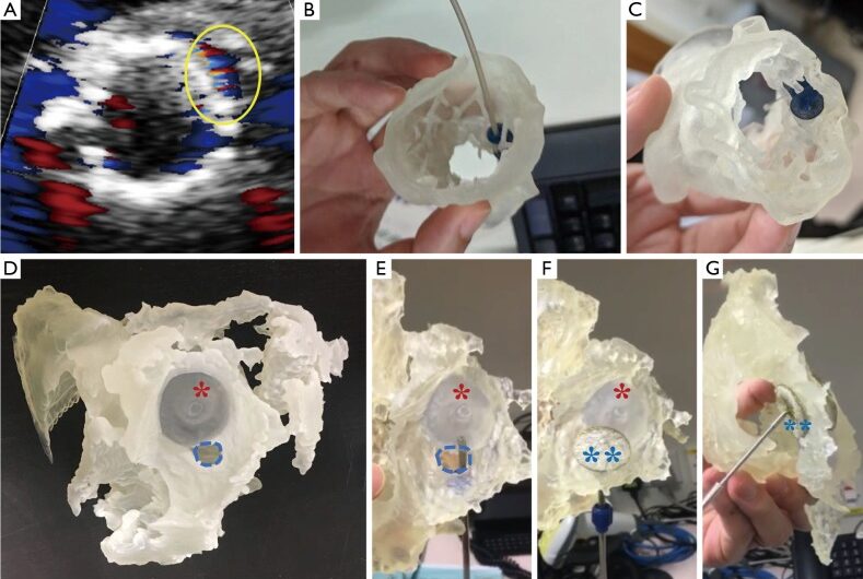 Chinese University of Hong Kong Studies 3D Printing for Heart Disease